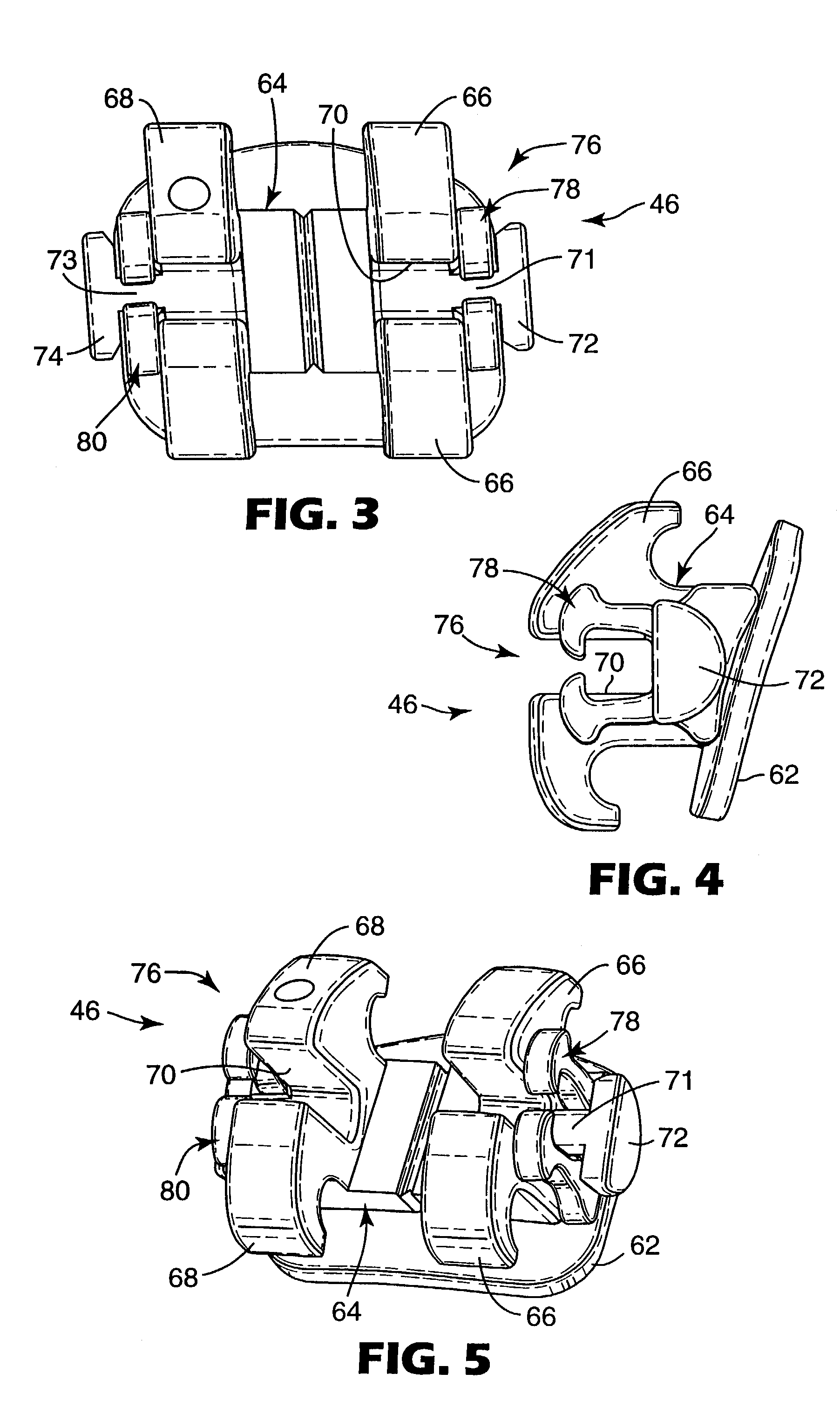 Orthodontic brace with self-releasing appliances
