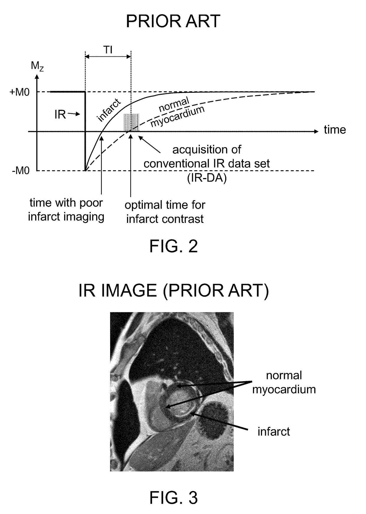 Systems And Methods For Phase-Sensitive Inversion Recovery MR Imaging With Reduced Sensitivity To Cardiac Motion