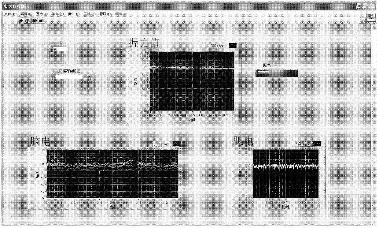 Synchronization likehood-based electroencephalograph and electromyography synergistic analyzing method