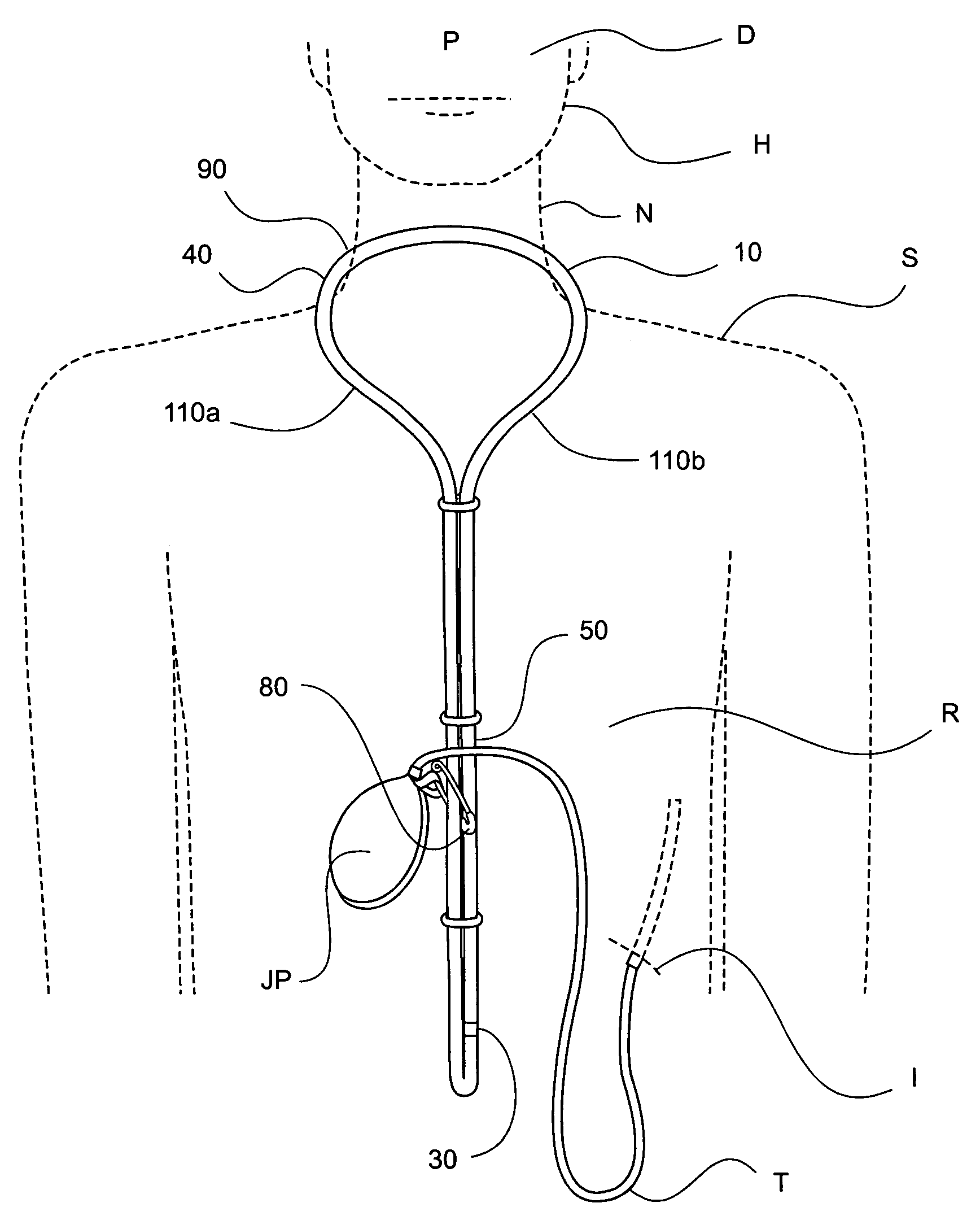 Device and method for supporting wound drainage systems