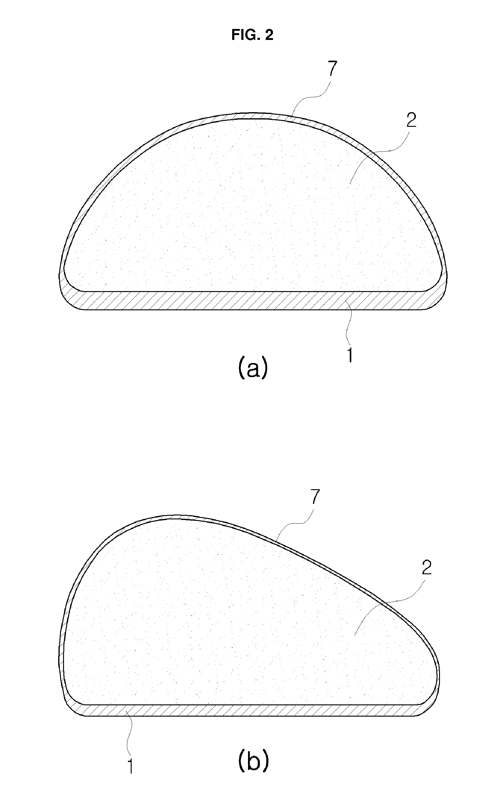 Round or anatomical type silicone prosthesis having shell with enhanced durability and method for manufacturing same