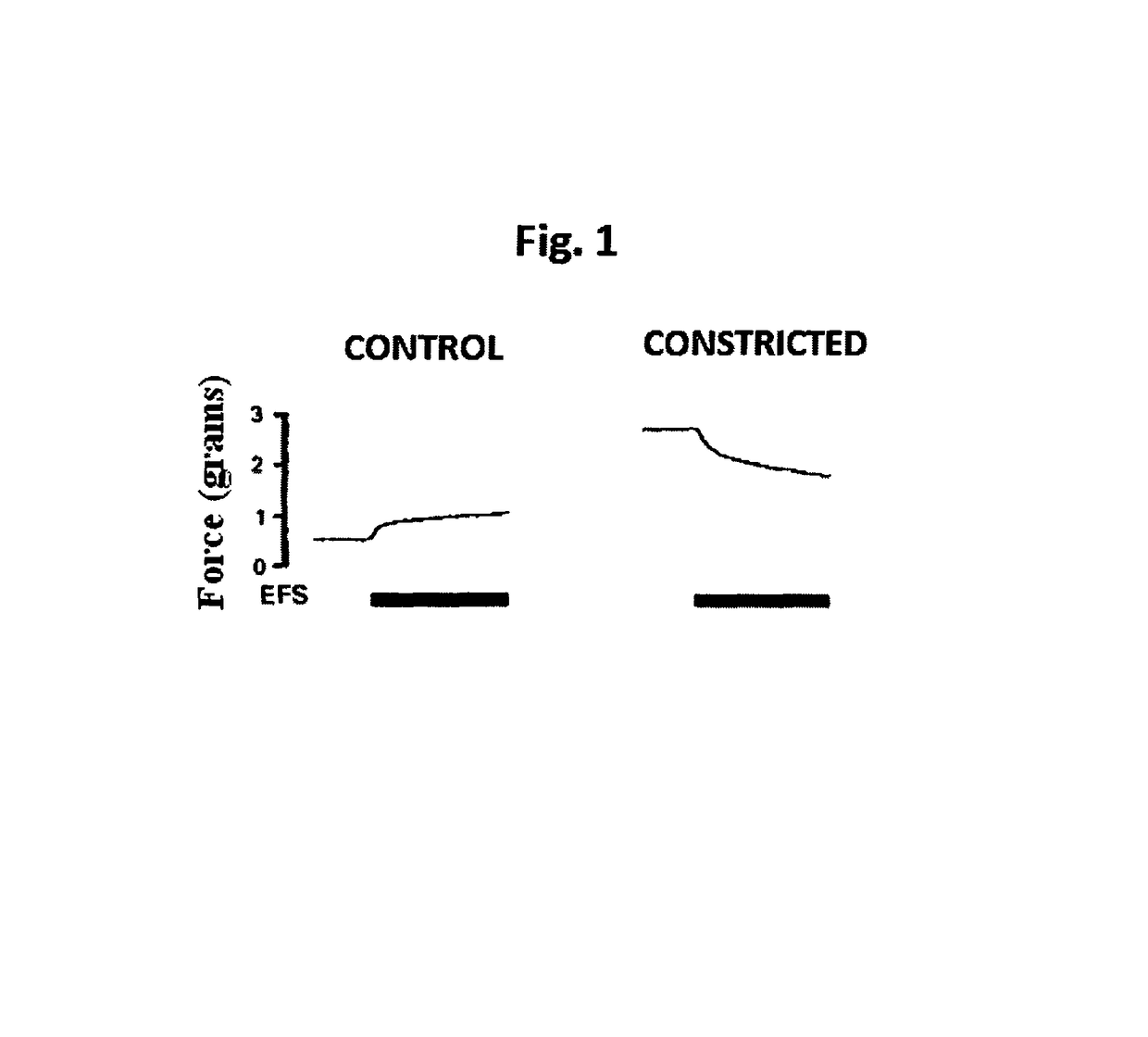 Use of magnetic stimulation to modulate muscle contraction