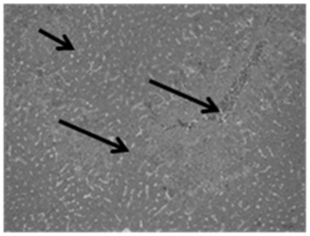 A kind of selenium-enriched Viola leaf broken rice chestnut extract and its application in liver protection