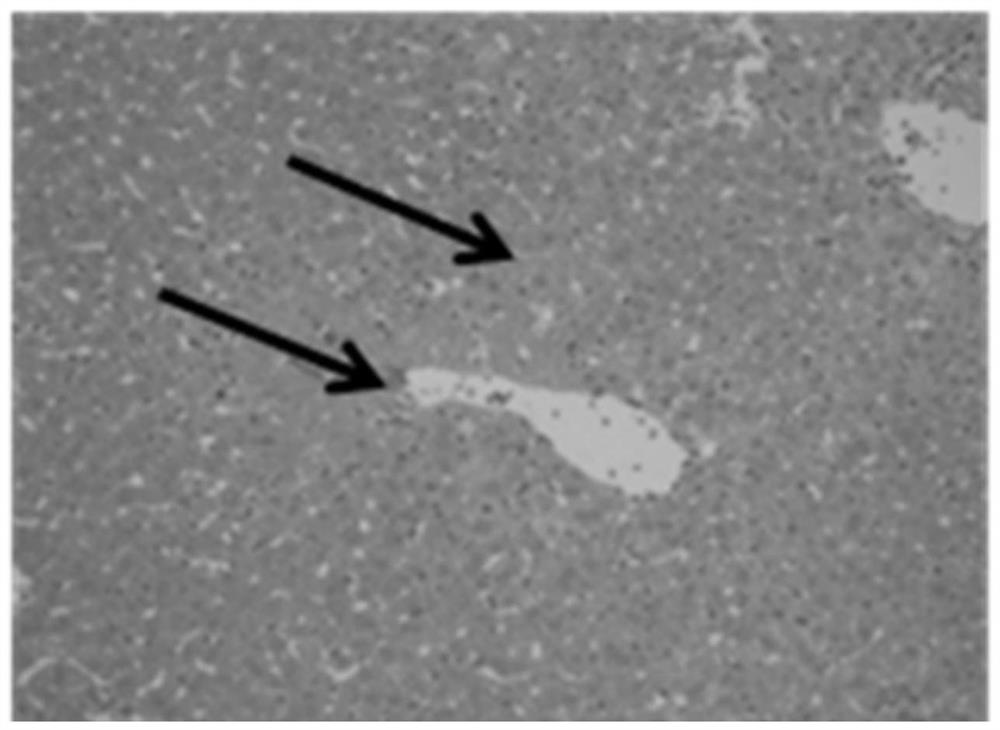 A kind of selenium-enriched Viola leaf broken rice chestnut extract and its application in liver protection