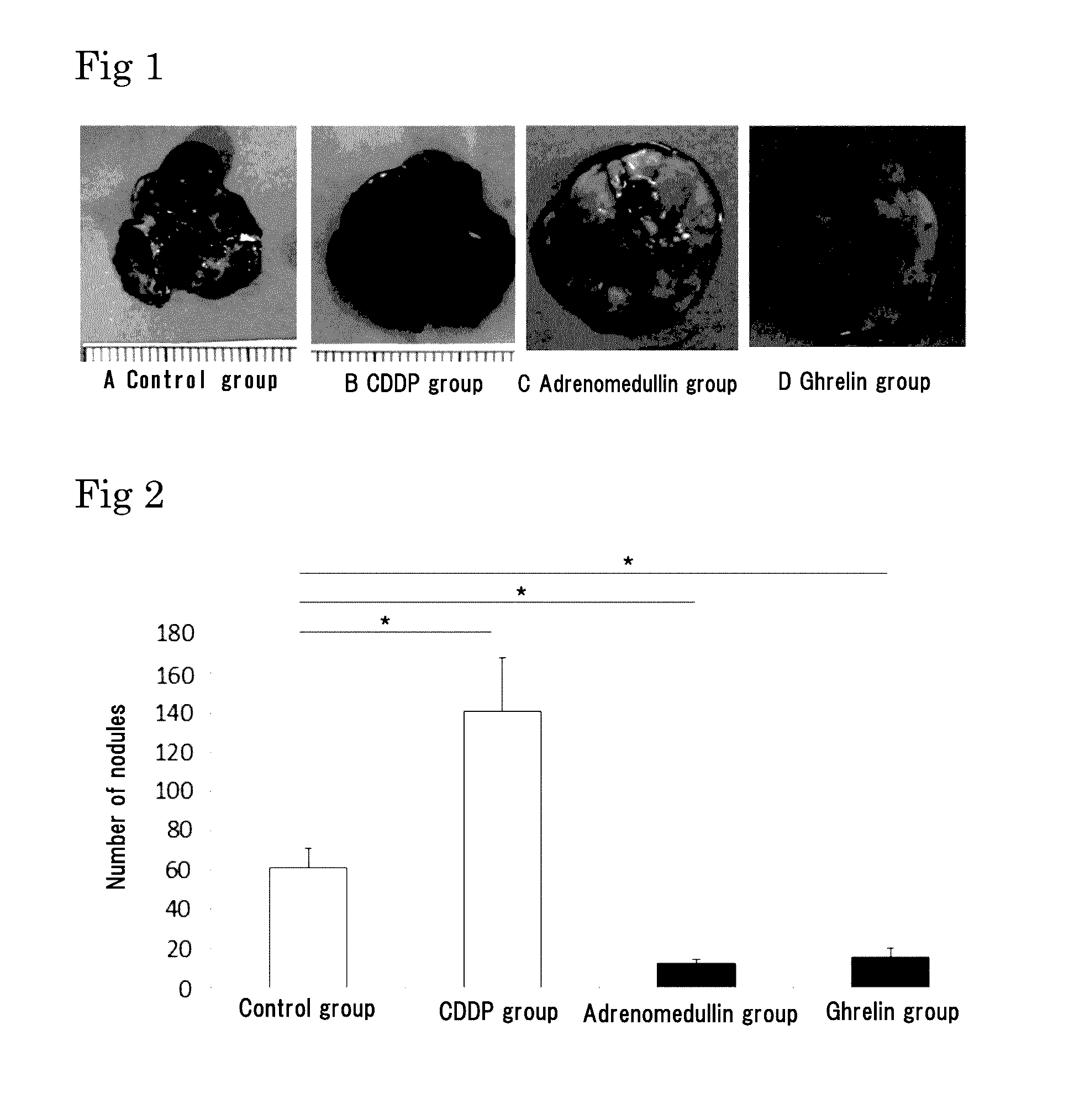 Medicinal agent for suppressing malignant tumor metastasis