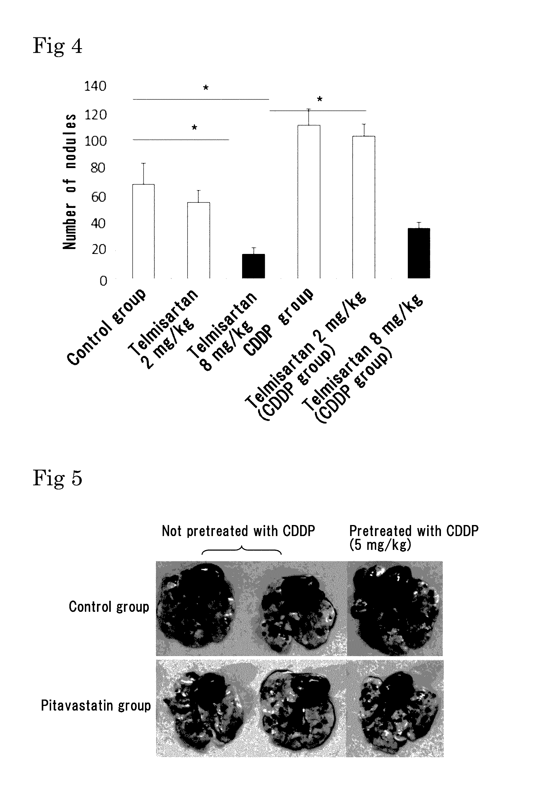 Medicinal agent for suppressing malignant tumor metastasis