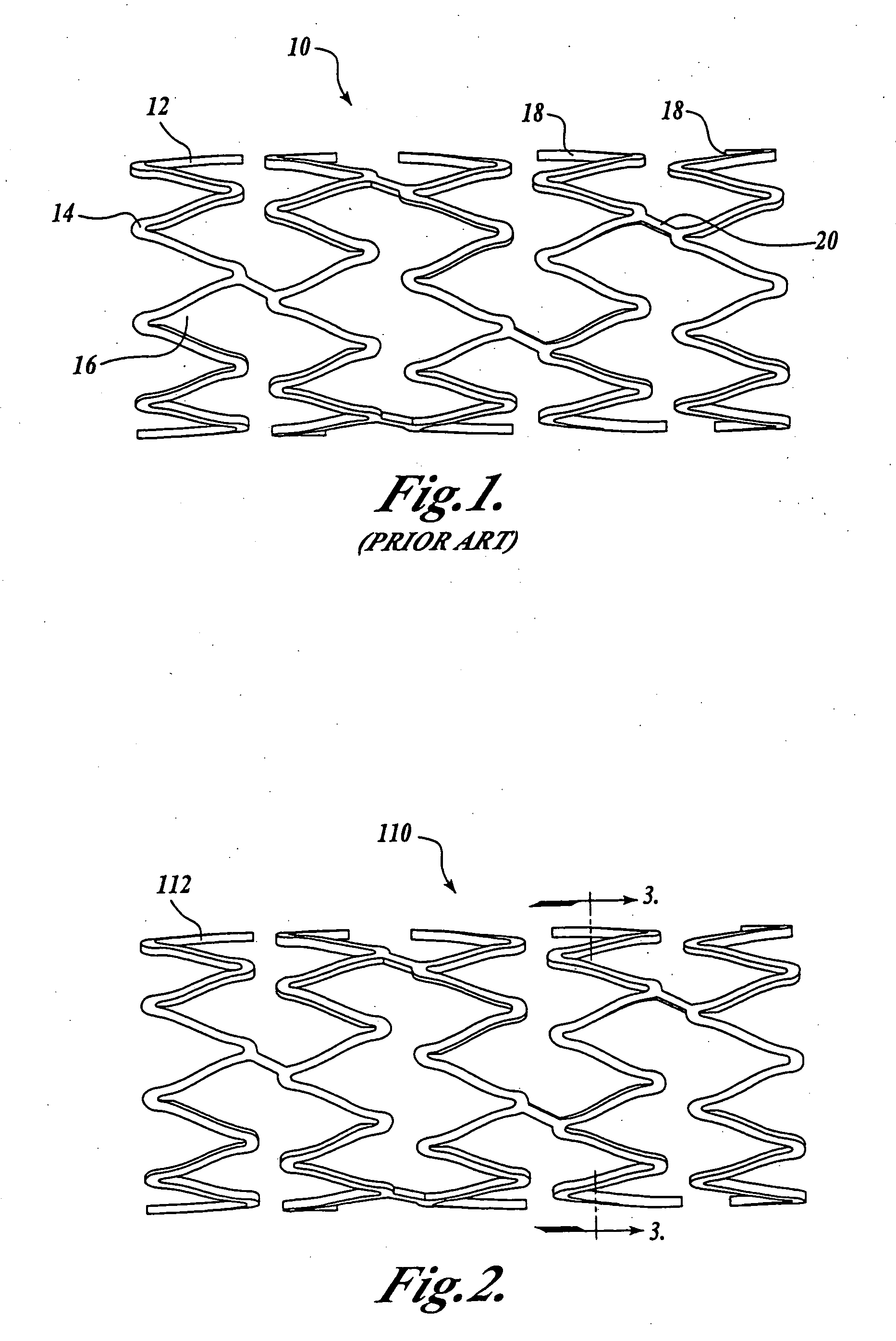 Medical device having radio-opacification and barrier layers