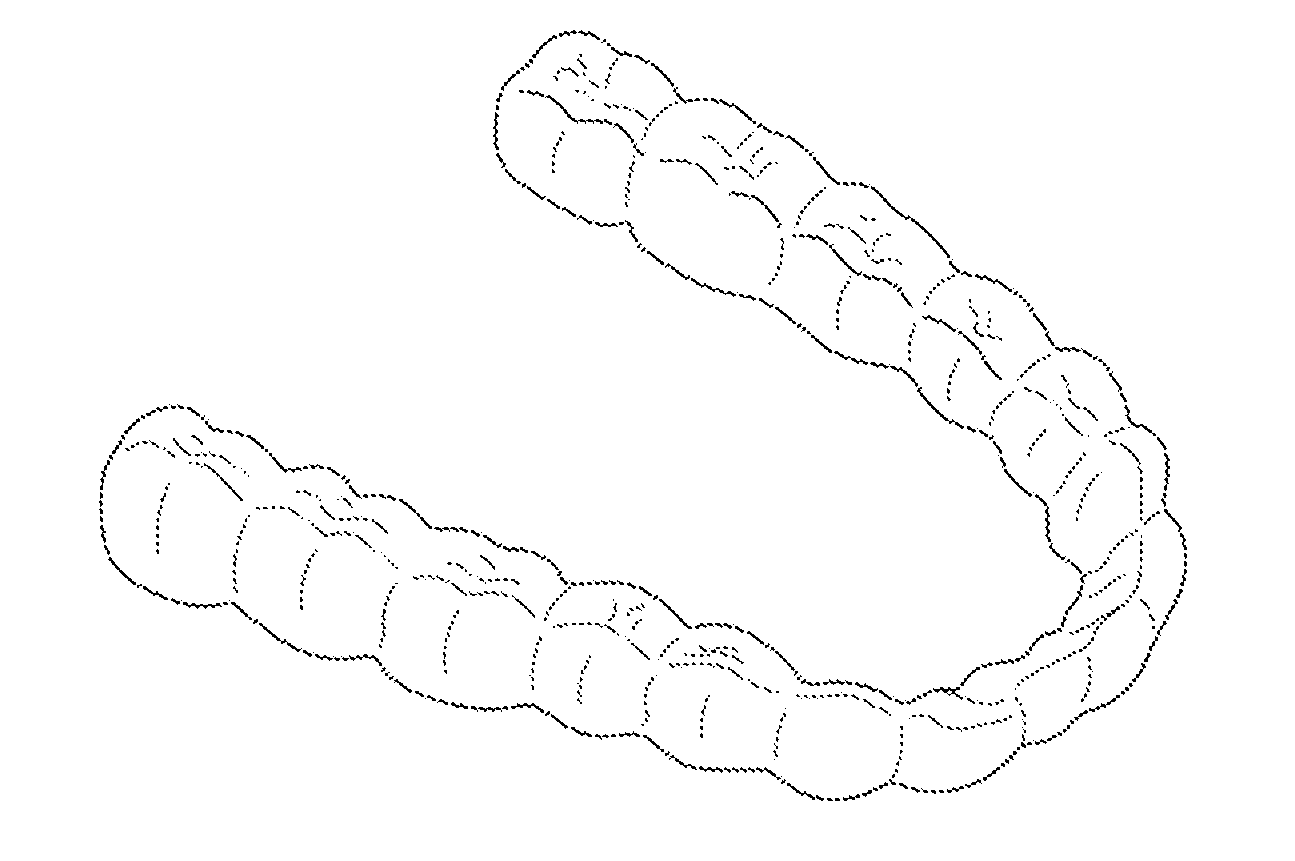 Pearlescent white aligners