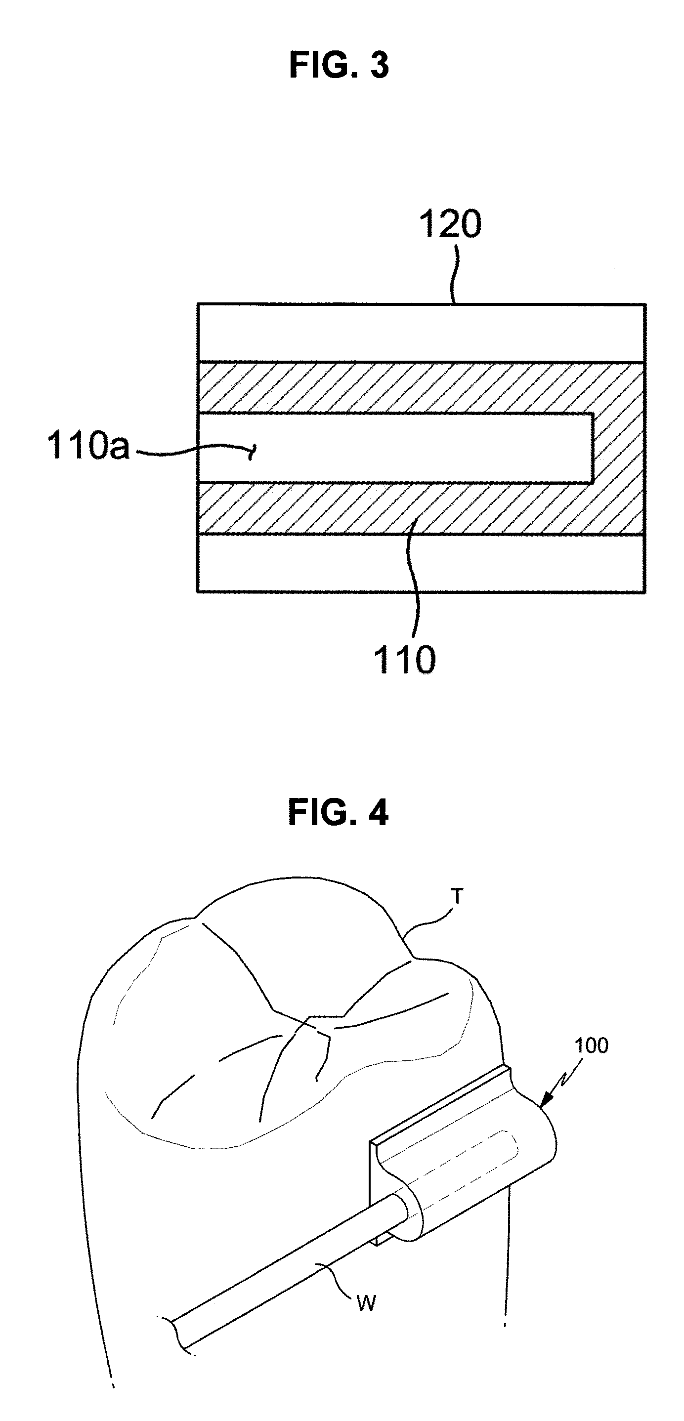 Dental wire supporter for orthodontic treatment and orthodontic device having the same
