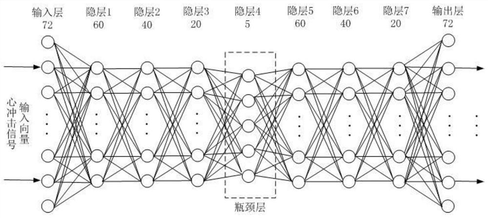 A Deep Bottleneck Feature Extraction Method of Cardiac Shock Signal Based on Deep Neural Network