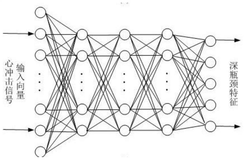 A Deep Bottleneck Feature Extraction Method of Cardiac Shock Signal Based on Deep Neural Network