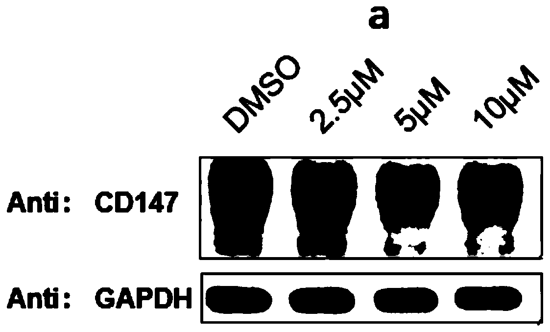 Protein degradation targeting chimeric body as well as preparation method and application thereof