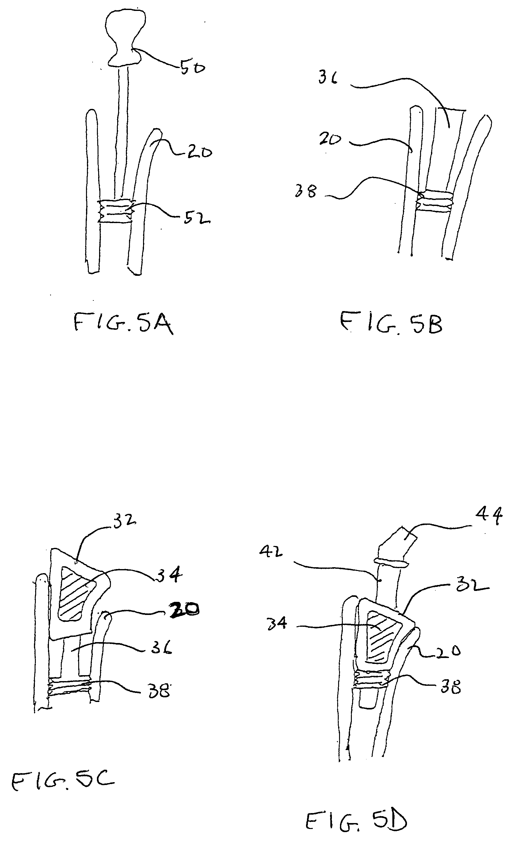 Arthroplasty and fixation devices with threaded intramedullary component