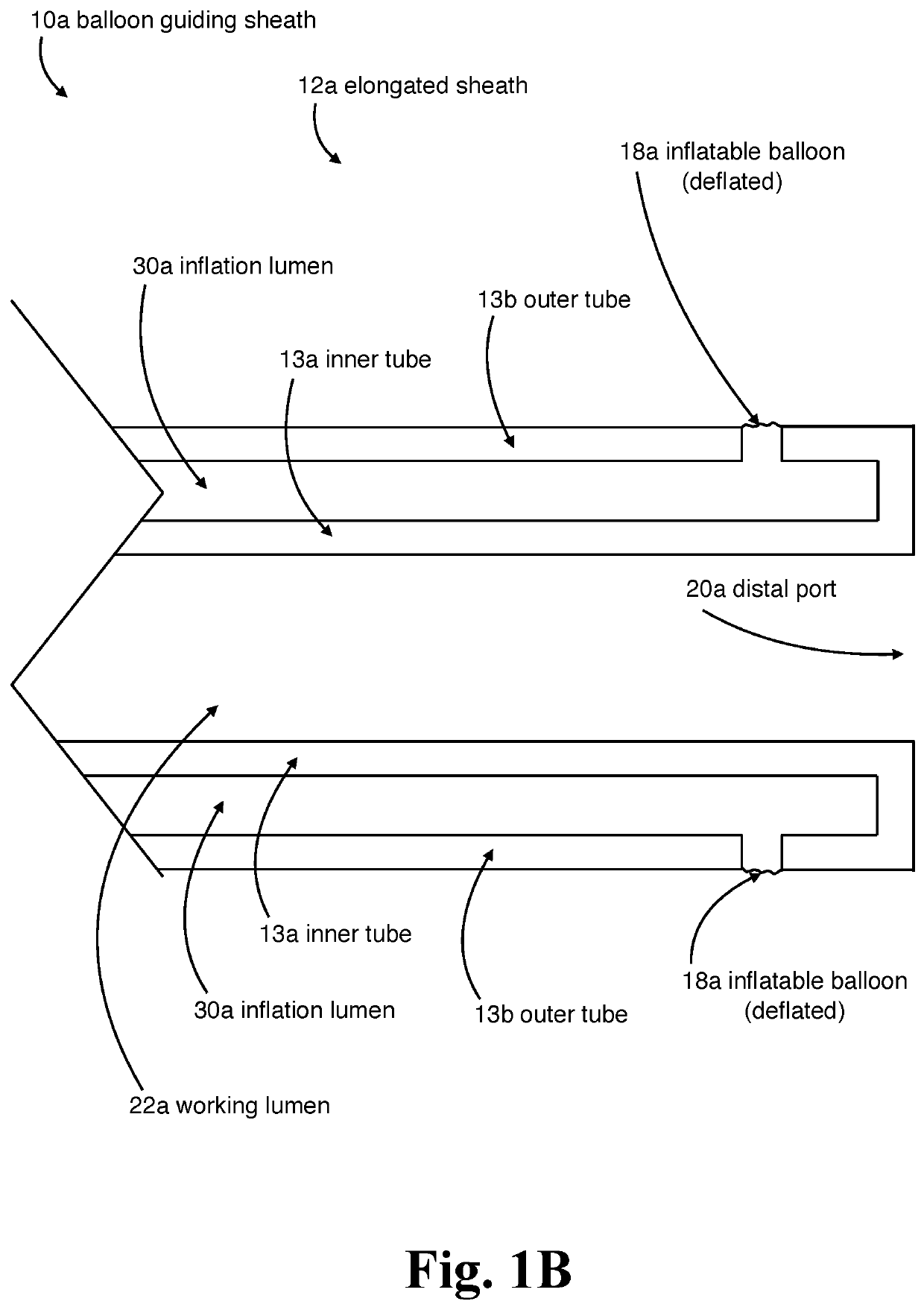 Internal carotid artery thrombectomy devices and methods