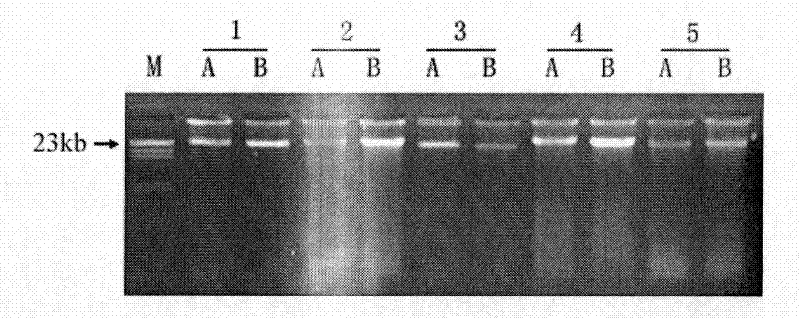 Simple, efficient and cheap method for purifying forest soil sample DNA