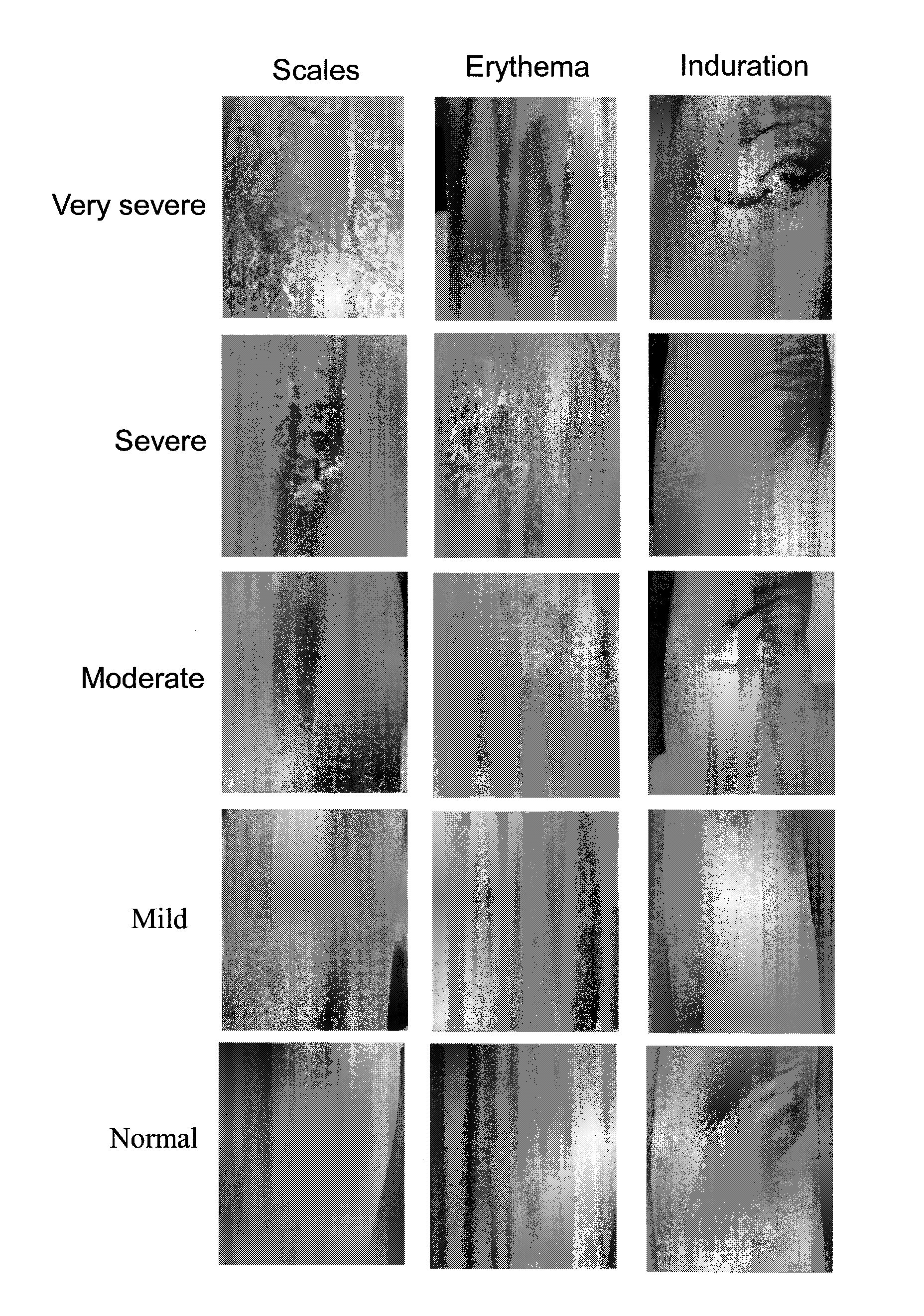 Oil-extracted product of indigo naturalis, and preparation process and uses thereof