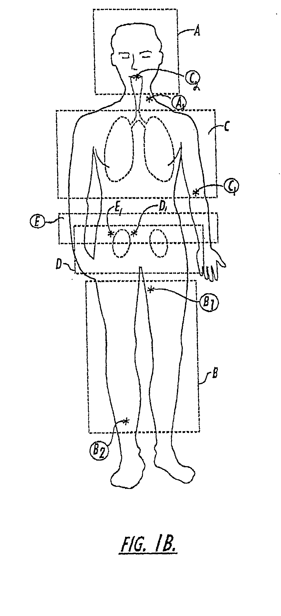 Diagnostic procedures using direct injection of gaseous hyperpolarized 129Xe and associated systems and products