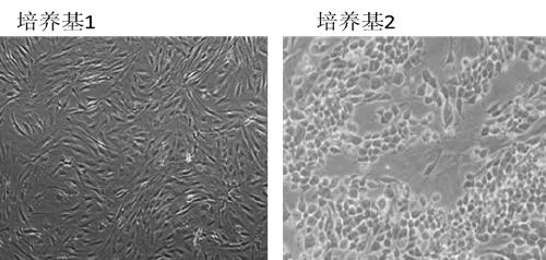 A serum-free medium for human adipose-derived mesenchymal stem cells and preparation method thereof