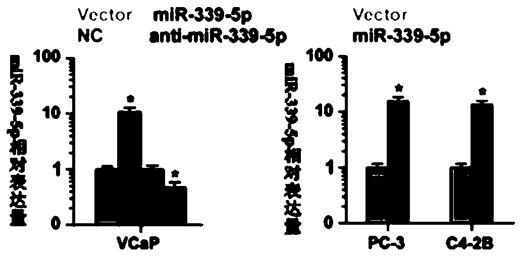 Application of mir-339-5p in inhibiting prostate cancer bone metastasis and TGF-β signaling pathway