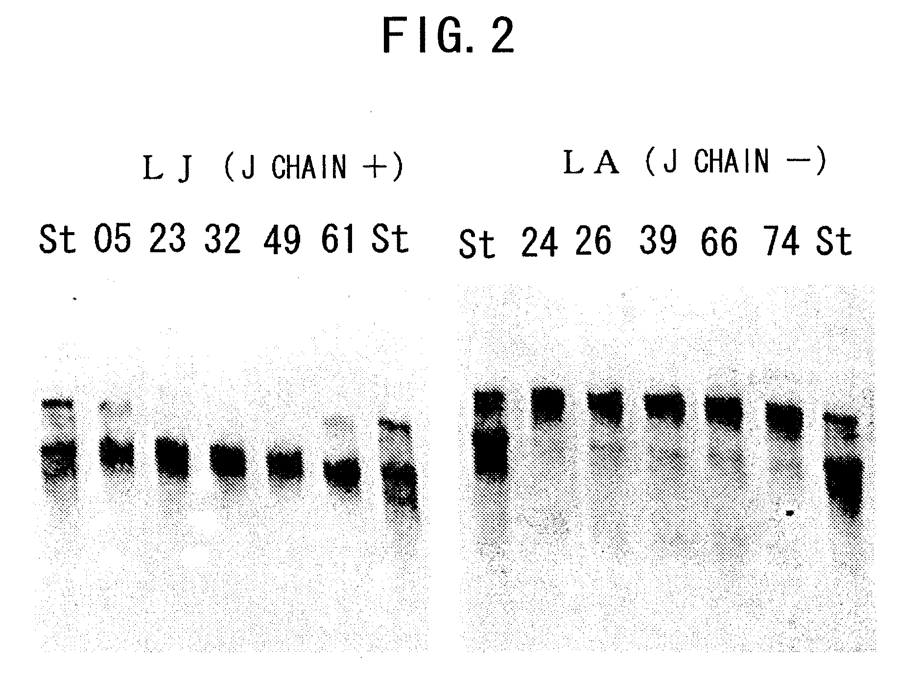 IgM Production by Transformed Cell and Method of Quantifying the Same