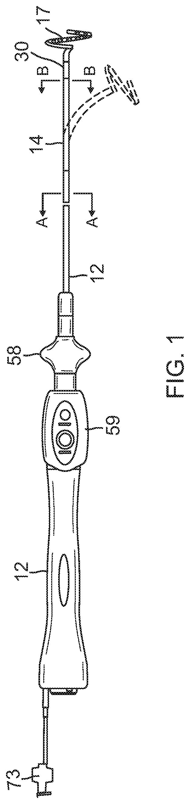 Catheter with improved loop contraction and greater contraction displacement