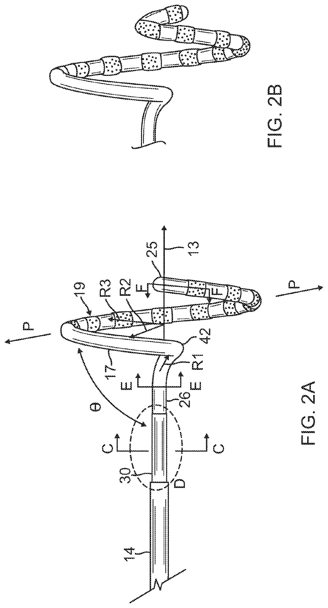 Catheter with improved loop contraction and greater contraction displacement