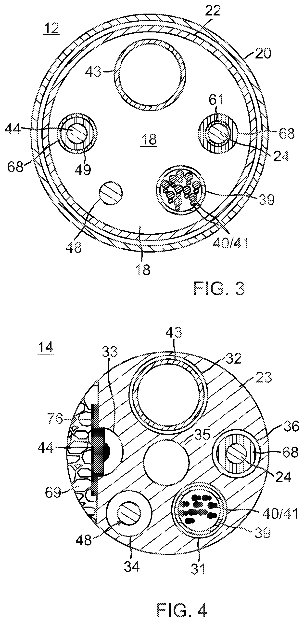 Catheter with improved loop contraction and greater contraction displacement