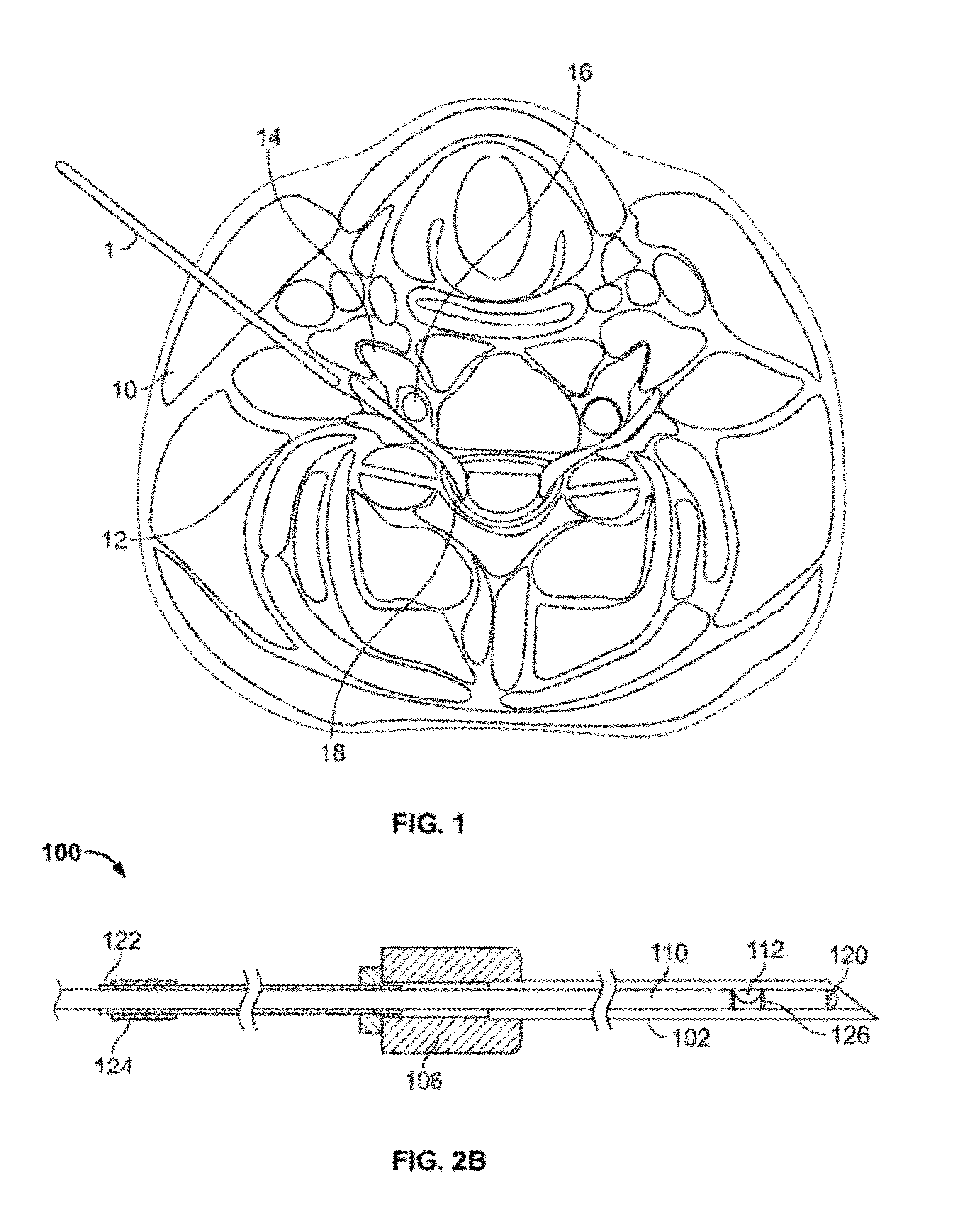 Method of accessing two lateral recesses