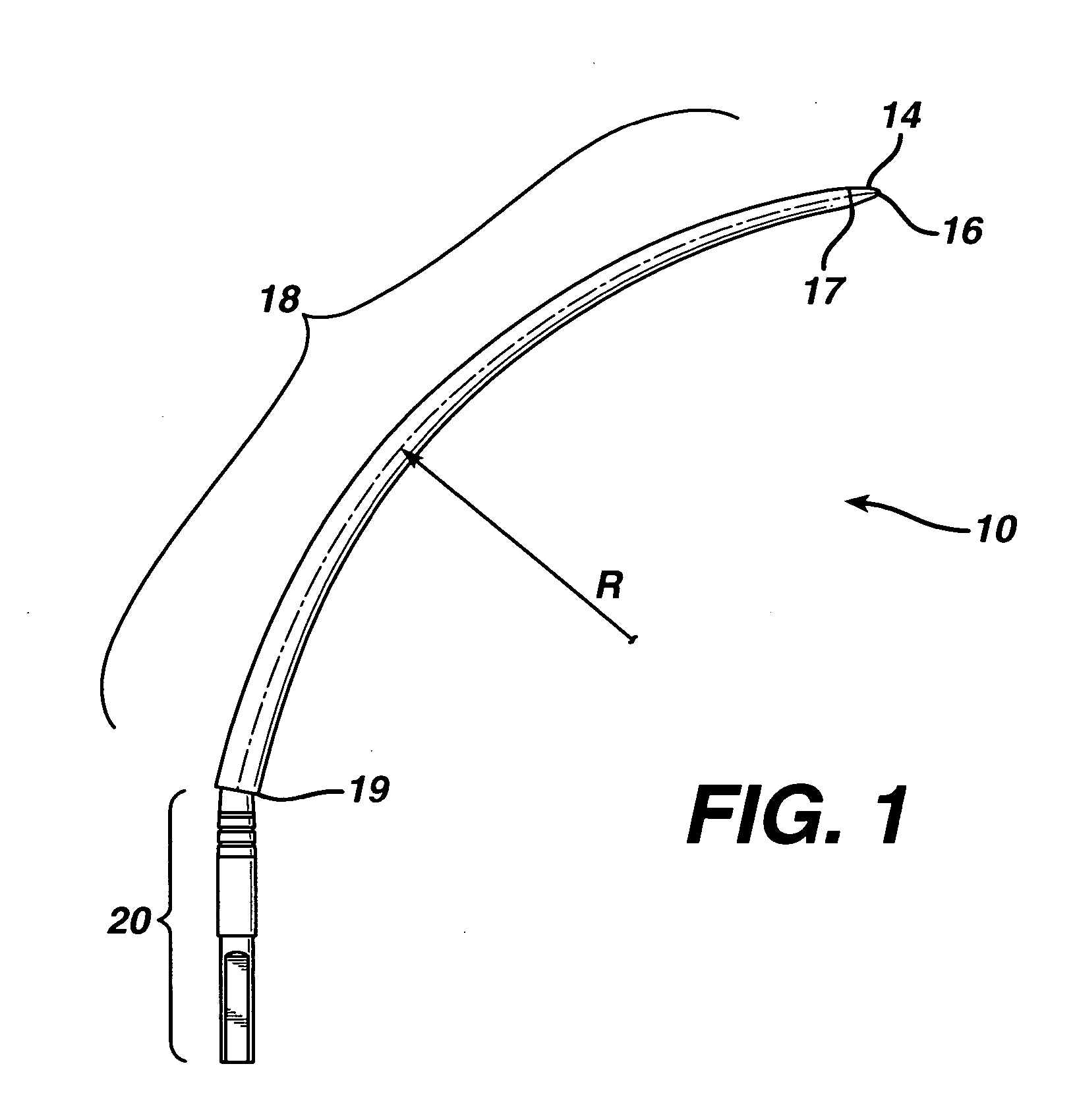 Method and apparatus for adjusting flexible areal polymer implants
