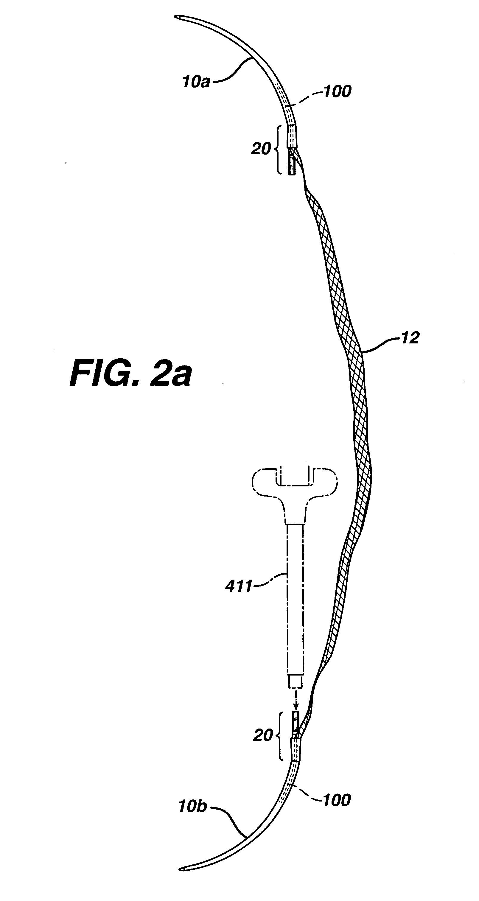 Method and apparatus for adjusting flexible areal polymer implants