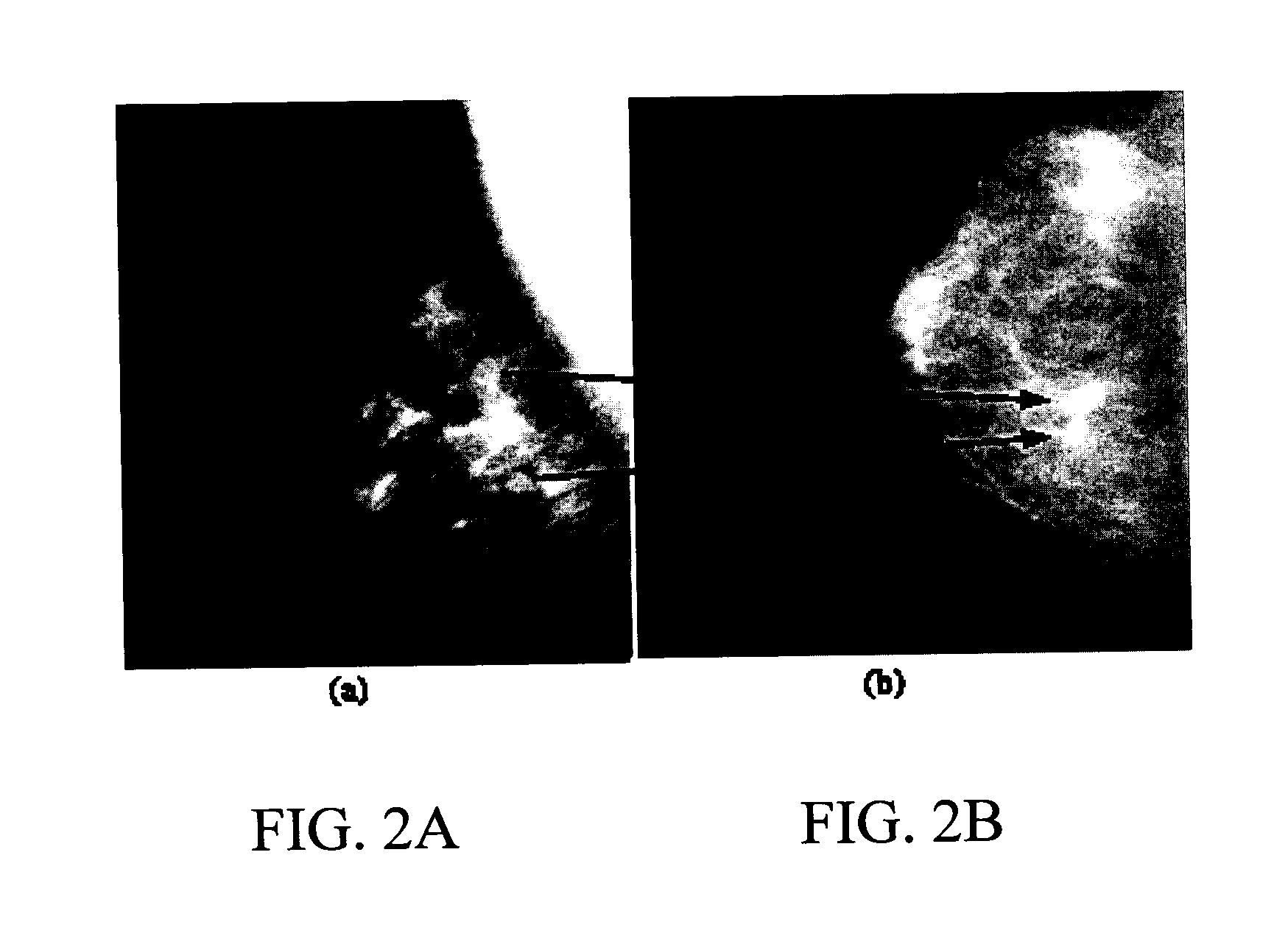 Method, system, and computer software product for feature-based correlation of lesions from multiple images