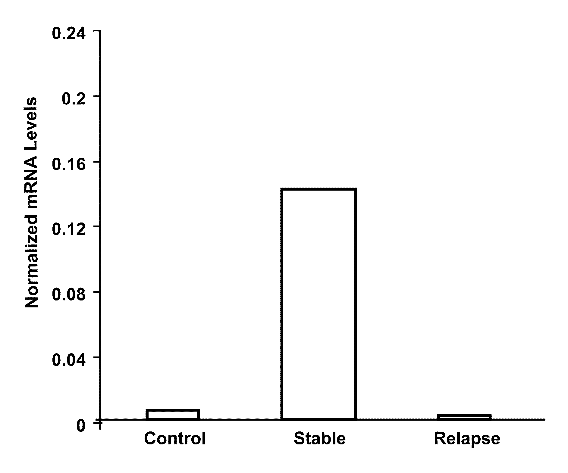 Marker of Diagnosis and Prognosis in Multiple Sclerosis