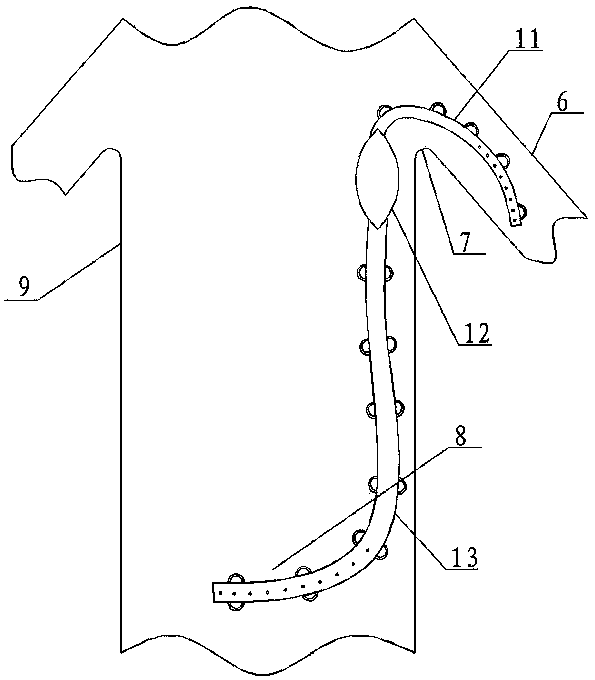 Special in-vivo drainage device for upper limb lymphedema of breast cancer postoperative complications and using method of special in-vivo drainage device