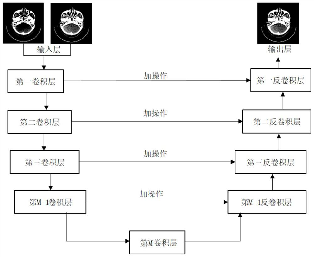 CT image black band artifact elimination method and system based on deep learning