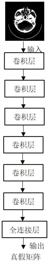 CT image black band artifact elimination method and system based on deep learning