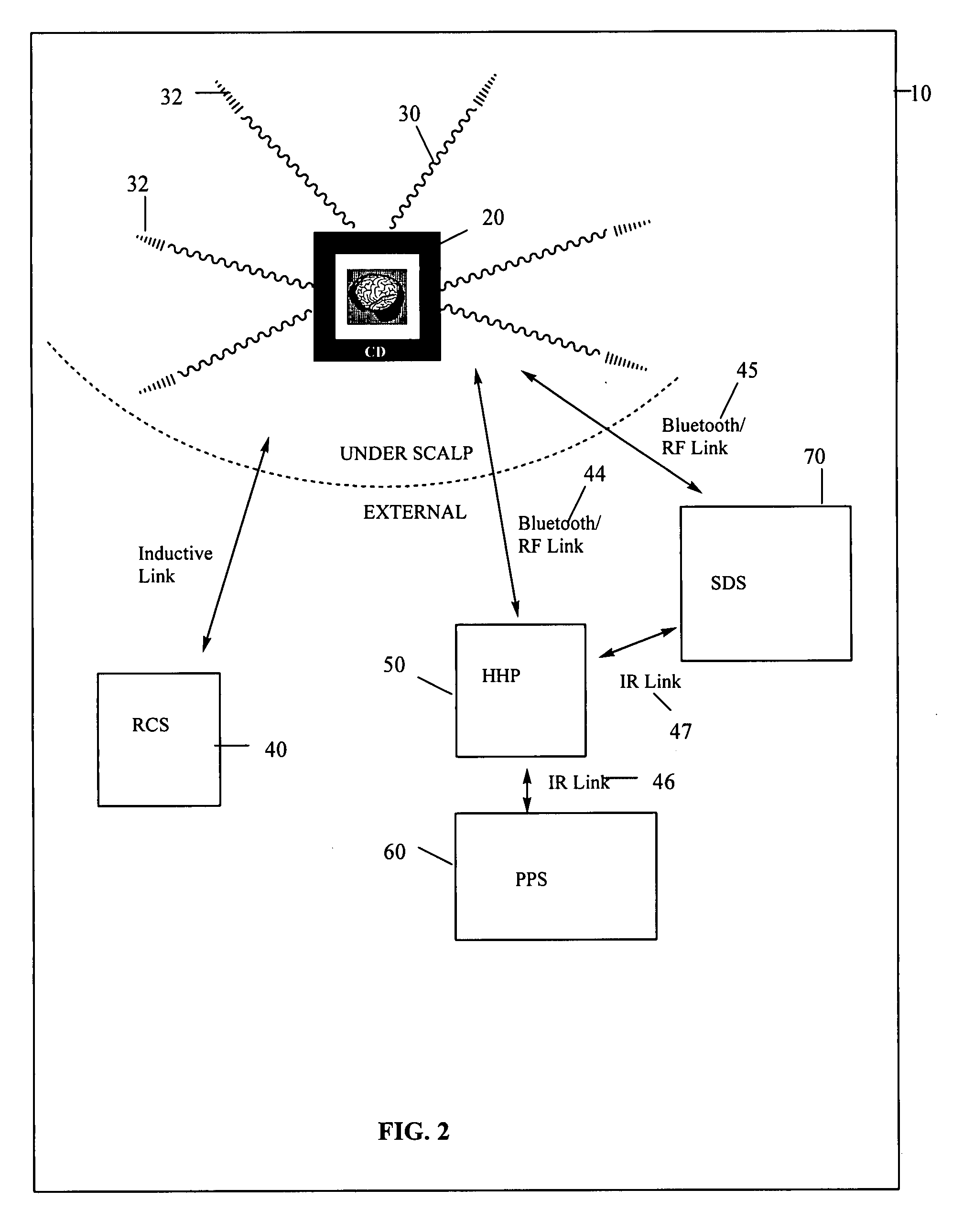 Device for multicentric brain modulation, repair and interface