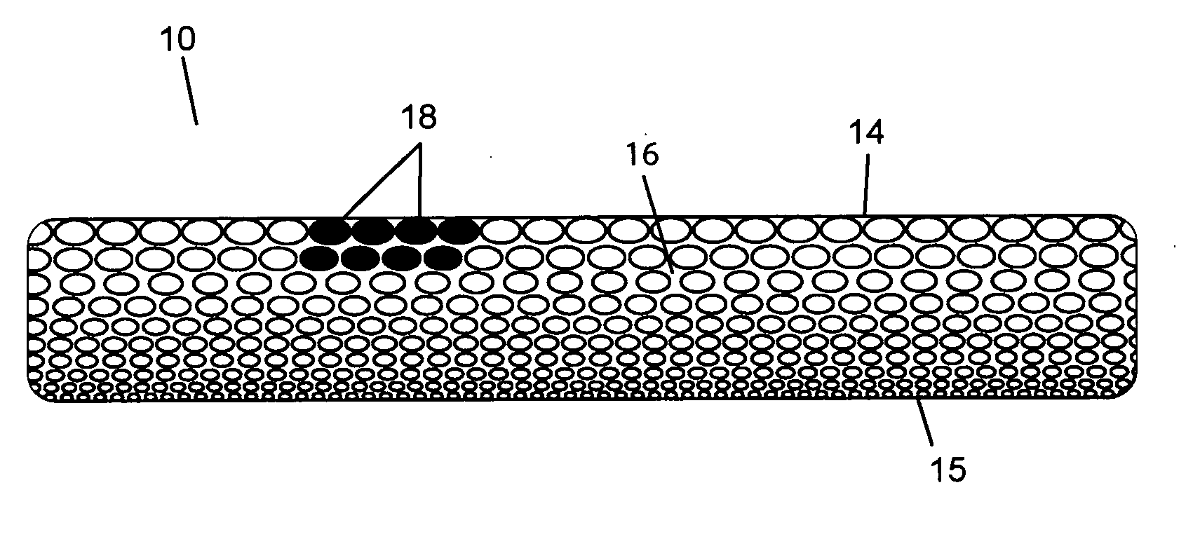 Resorbable polymeric device for localized drug delivery