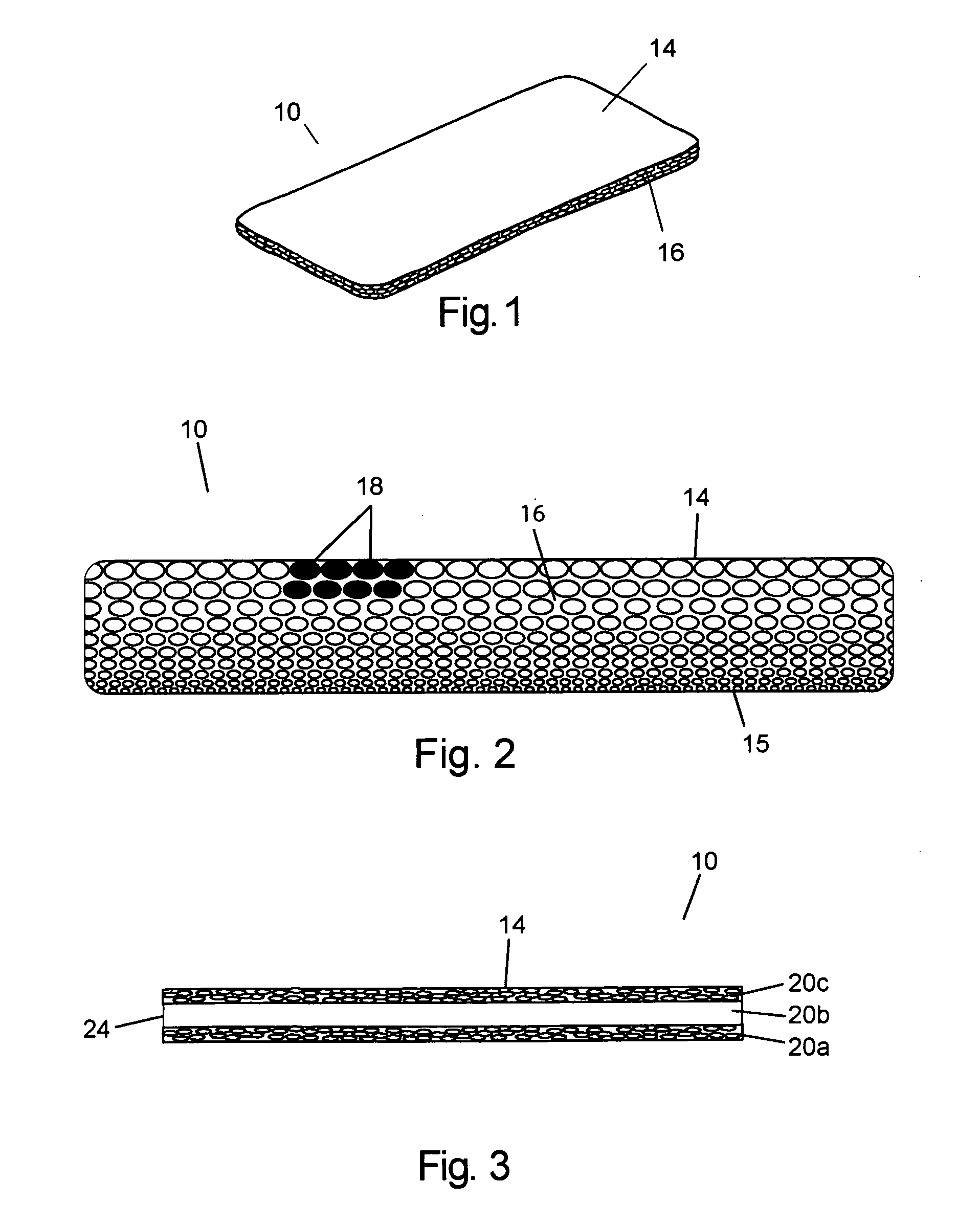 Resorbable polymeric device for localized drug delivery