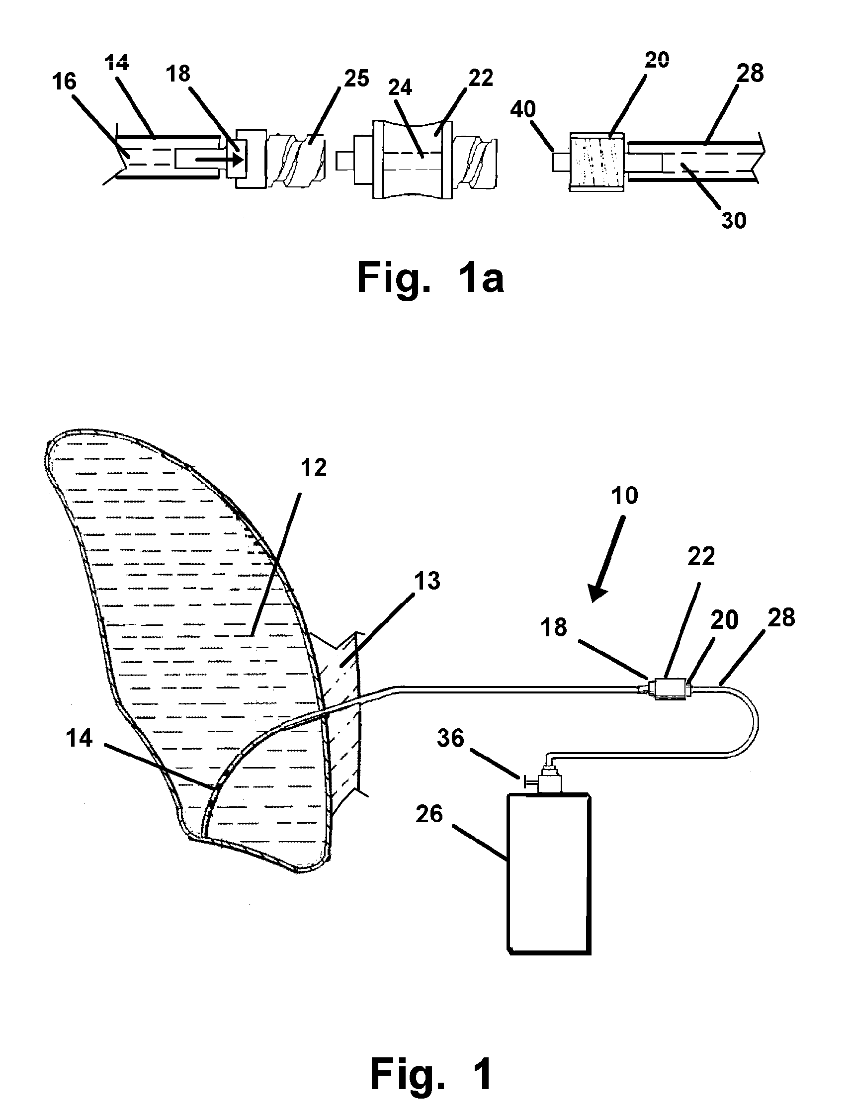 Method and Apparatus for Treatment of Pleural Effusion