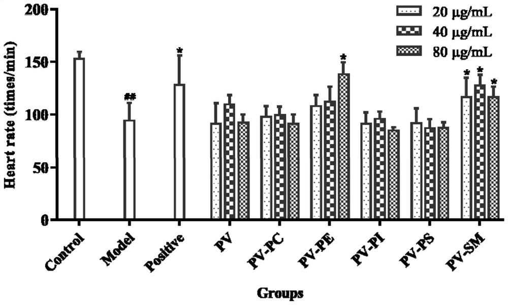 Application of marine phospholipid as effective component in preparation of medicine for preventing and/or treating heart diseases