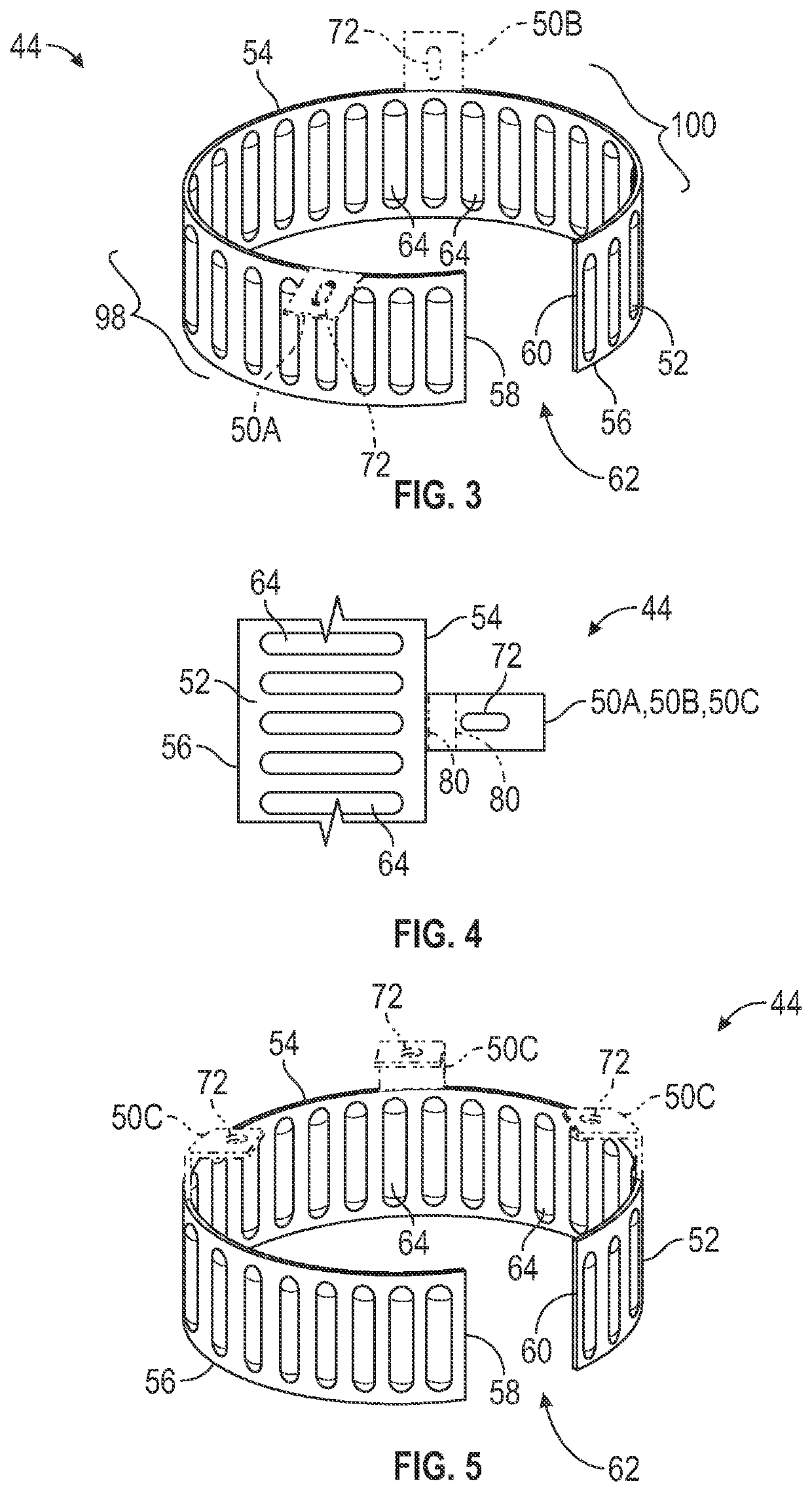 Sound reduction assembly, a ring configured to attenuate sound and a method