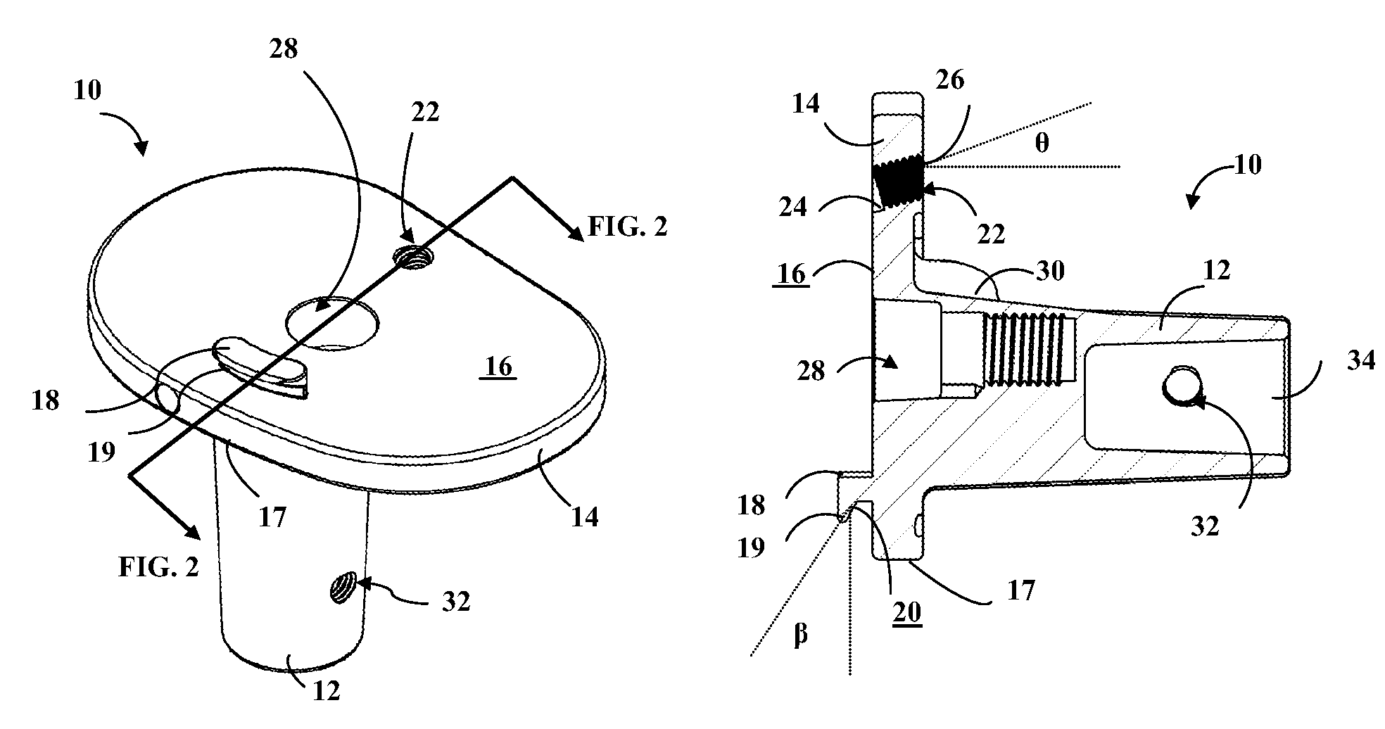 Orthopaedic implant system and fasteners for use therein
