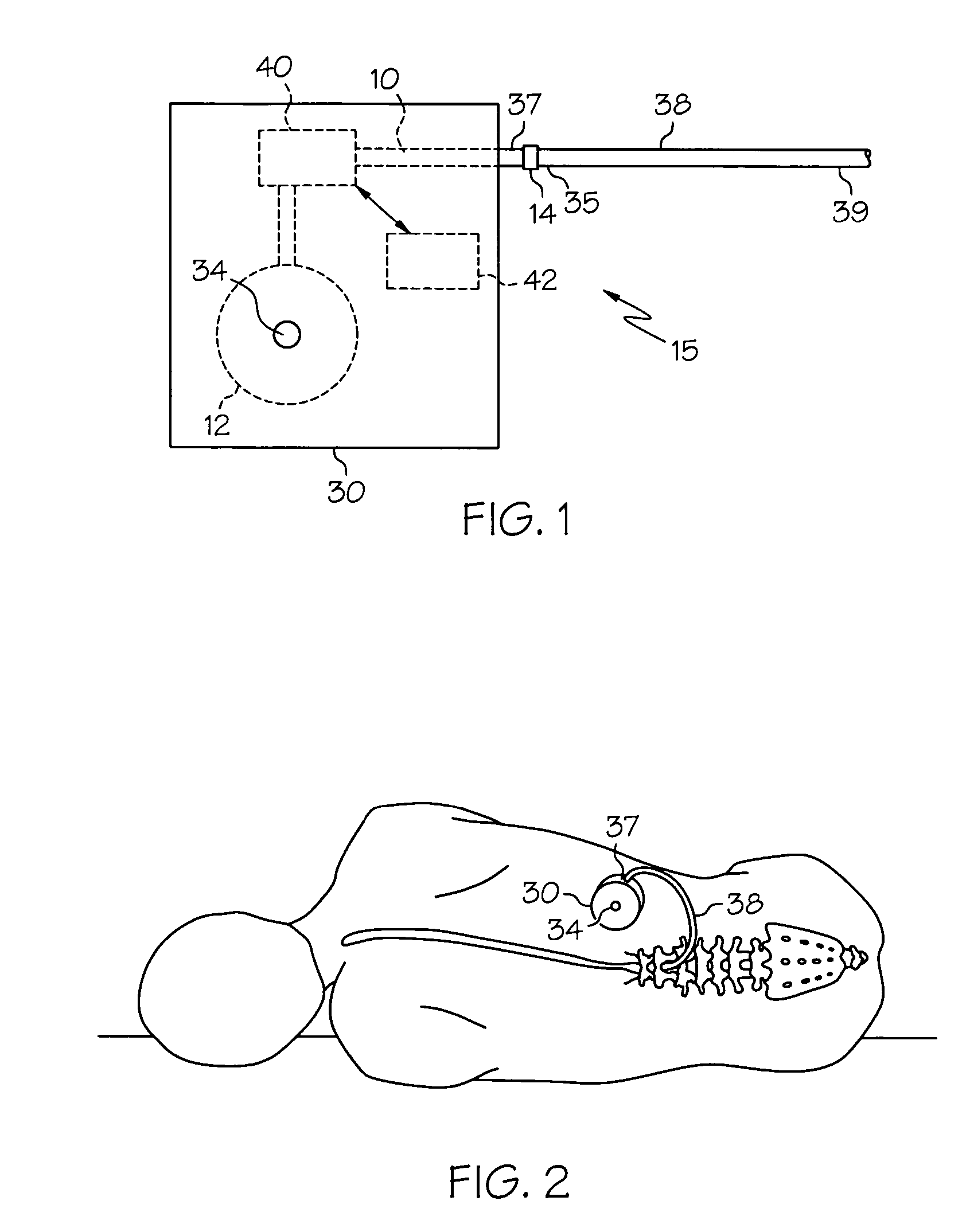Pump systems including injectable gabapentin compositions