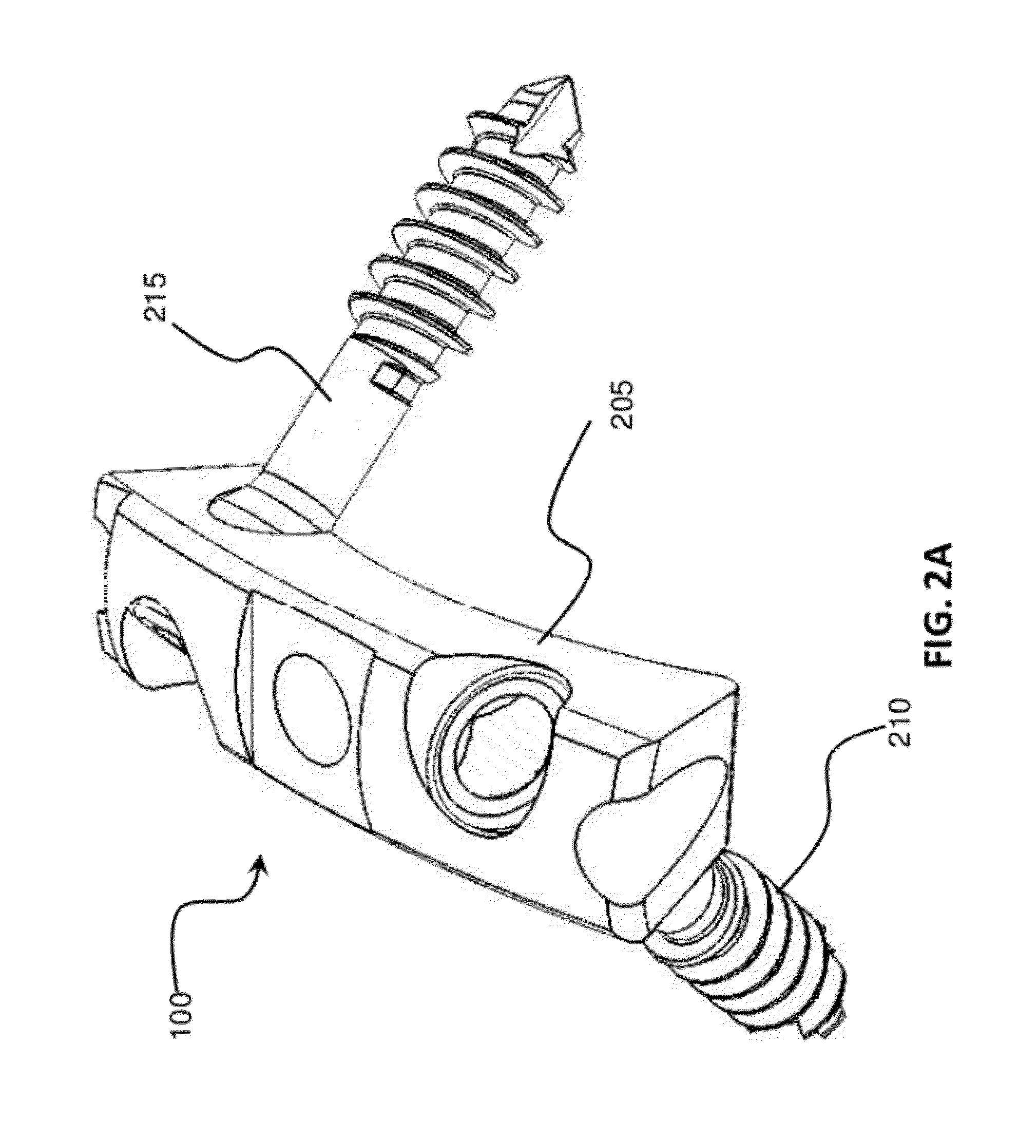 Intraosseous fixation assembly for an osteotomy and method of use