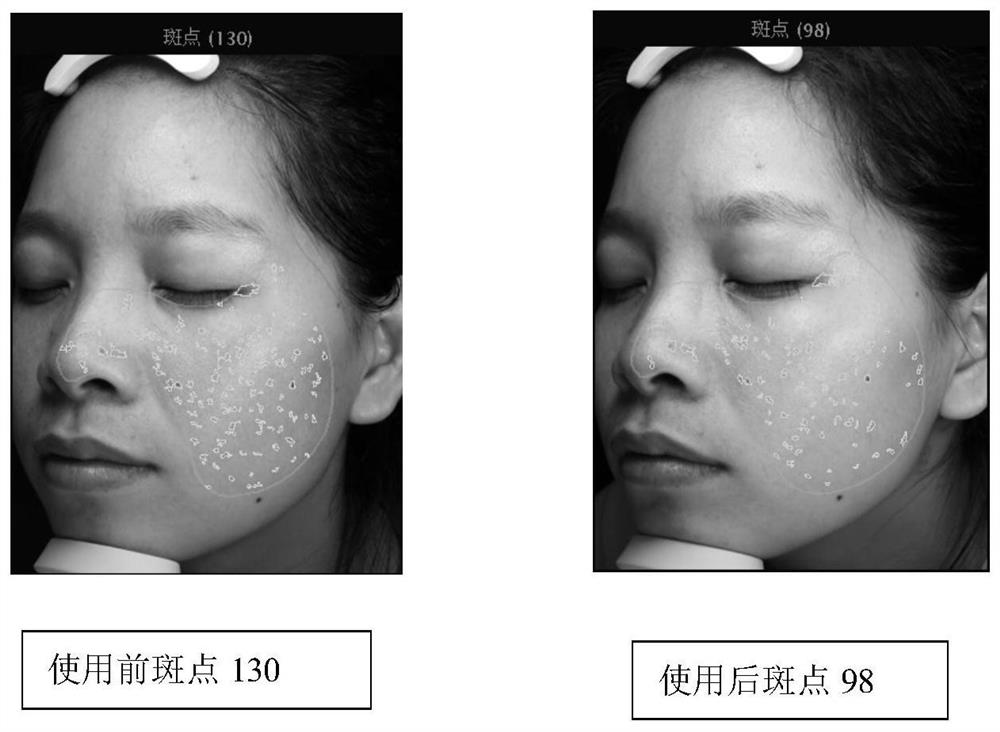 Brightening and anti-glycation composition containing carnosine and ergothioneine and application of brightening and anti-glycation composition