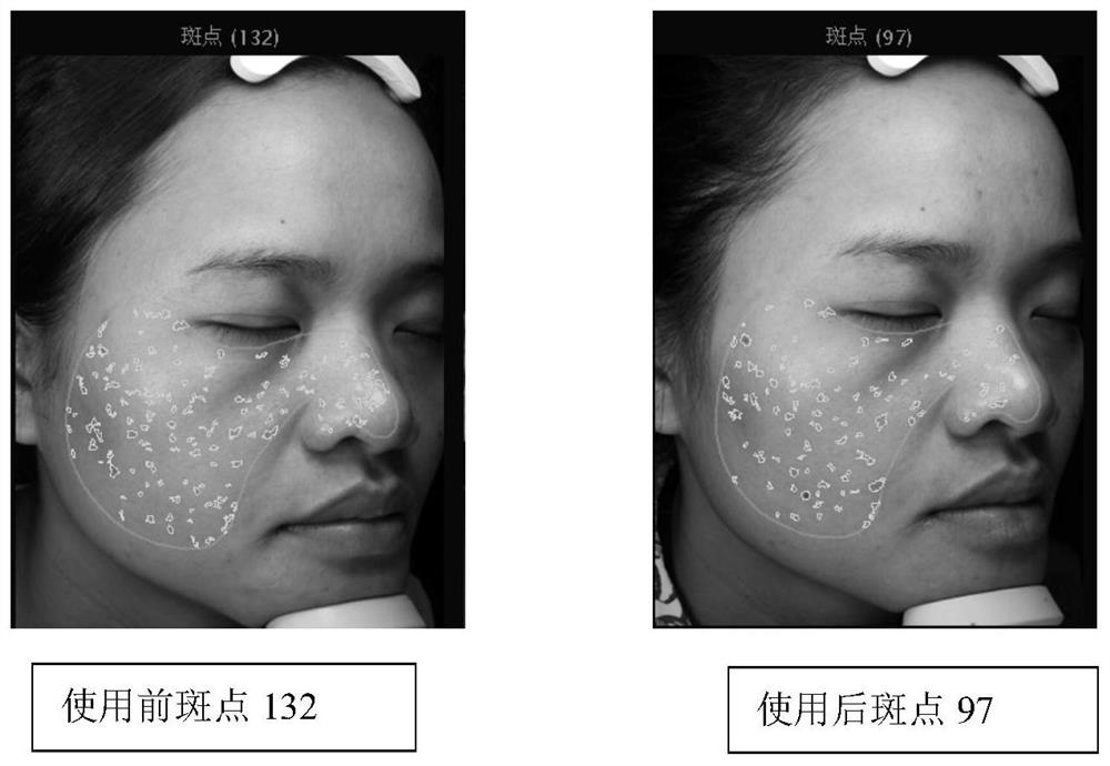 Brightening and anti-glycation composition containing carnosine and ergothioneine and application of brightening and anti-glycation composition