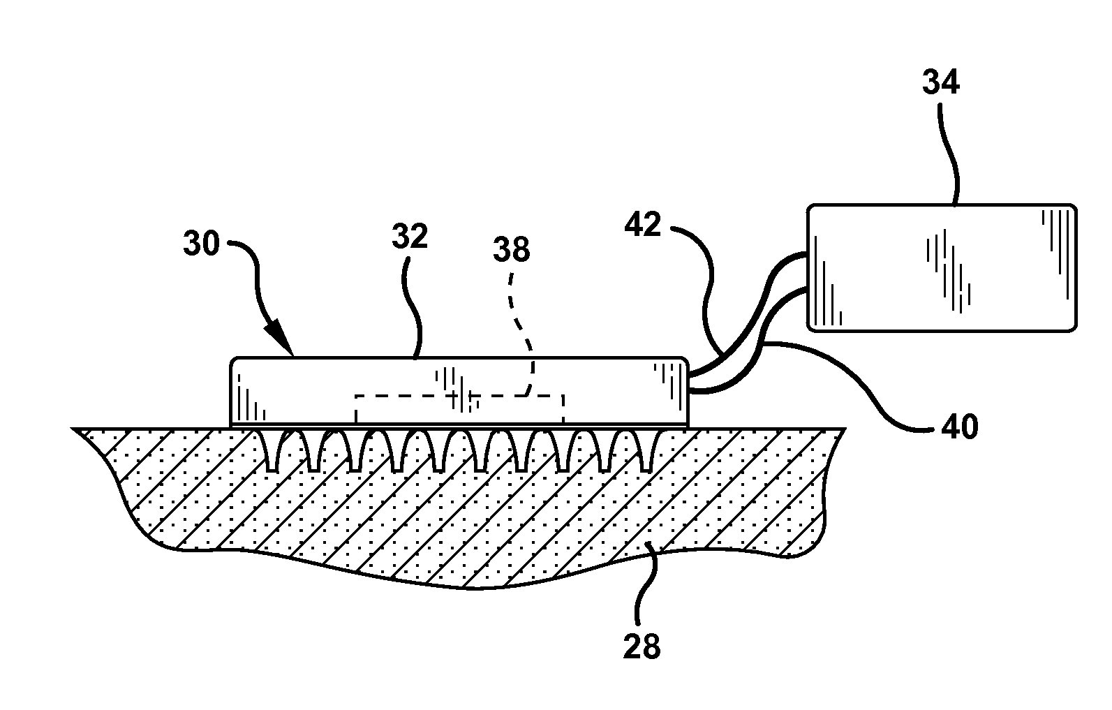Method and device for abrading skin
