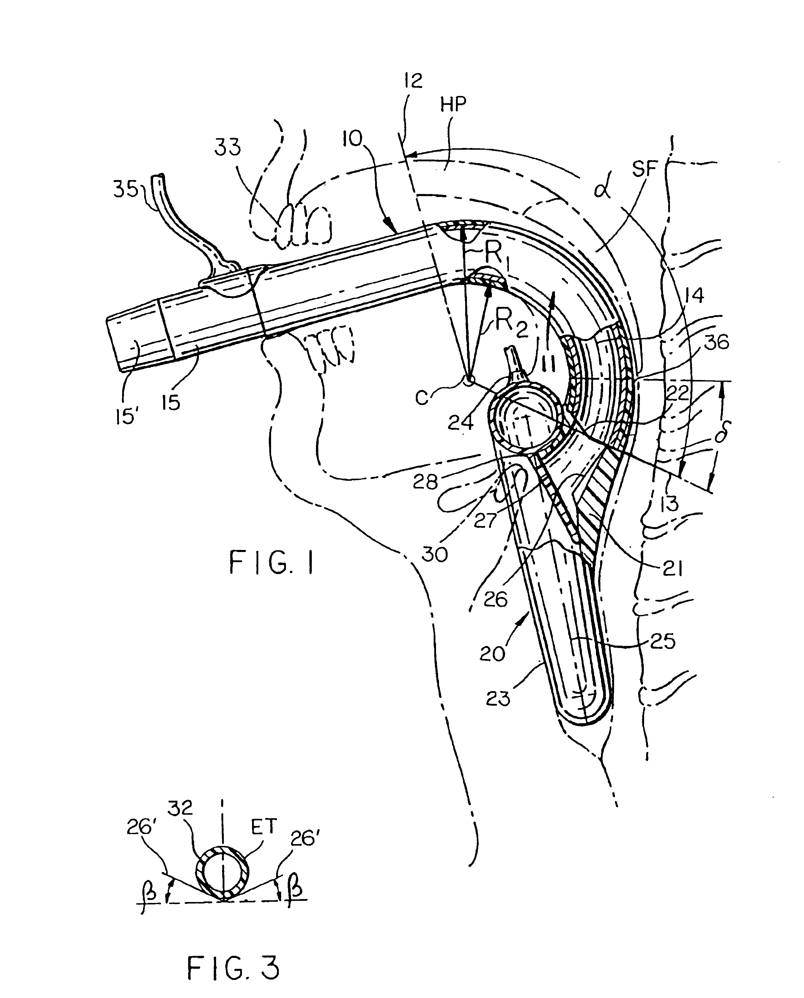 Intubating laryngeal mask