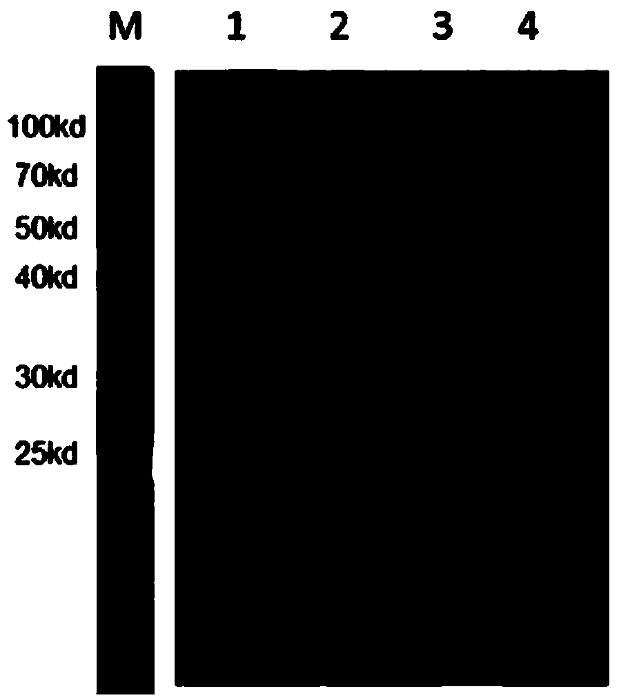 Apolygus lucorum ultraspiracle protein specific polyclonal antibody as well as preparation method and application thereof
