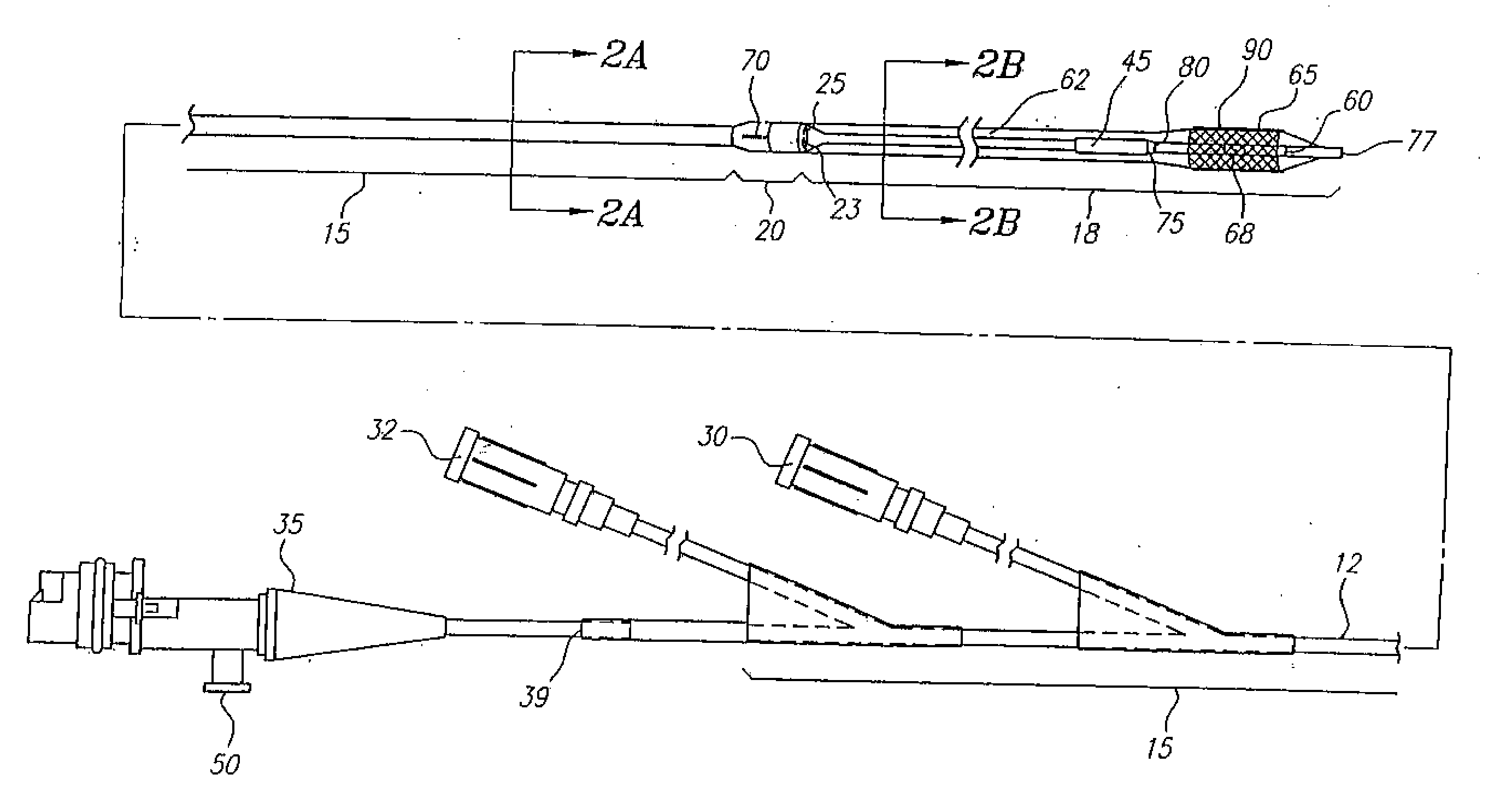 Catheter System Having Imaging, Balloon Angioplasty, And Stent Deployment Capabilities, And Method Of Use For Guided Stent Deployment